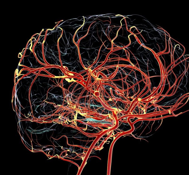 Alterações do Alzheimer podem surgir antes de falhas na memória, diz estudo