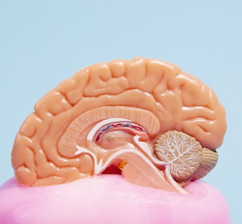 Estimulação cognitiva pode retardar perda de funções no Alzheimer