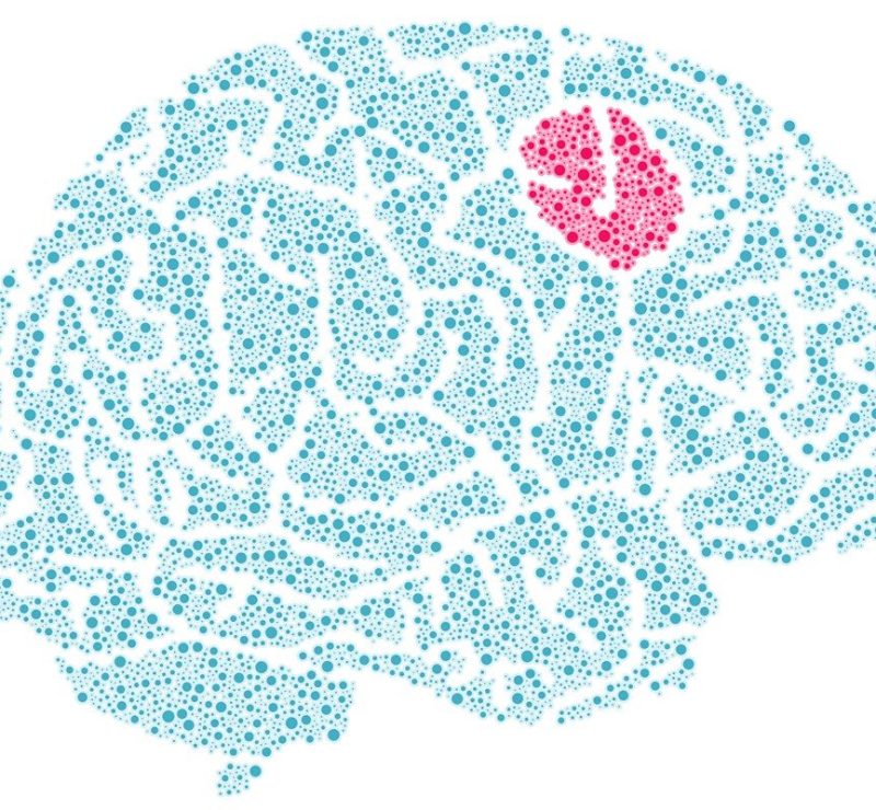 Novo teste promete fazer diagnóstico de tumor cerebral cair para duas horas