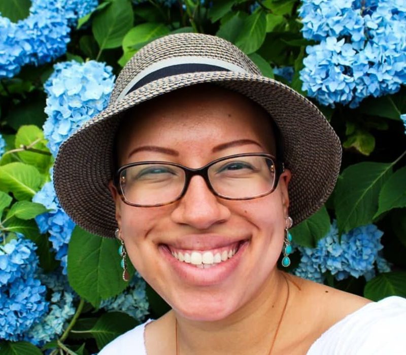 Pacientes com alopecia areata contam trajetória para reaver autoestima