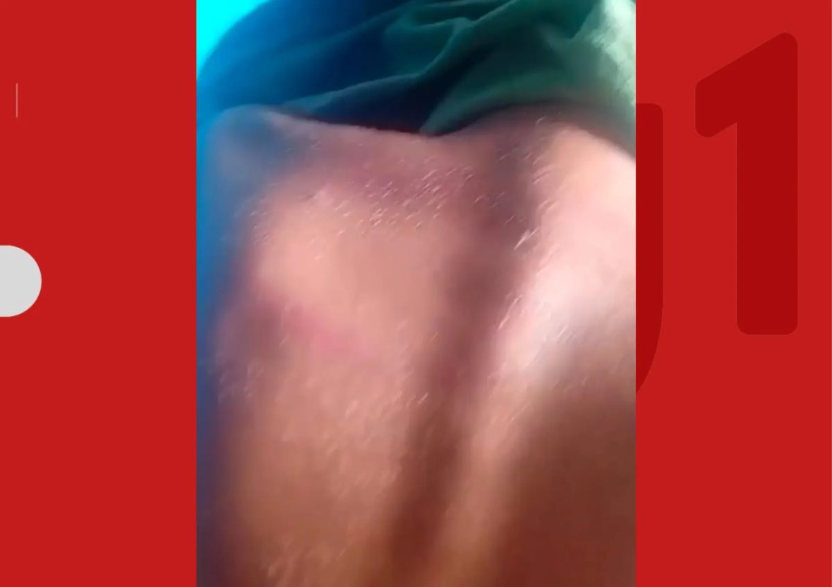 Professor é denunciado por agredir criança de 8 anos com cipó de goiabeira no sul da Bahia