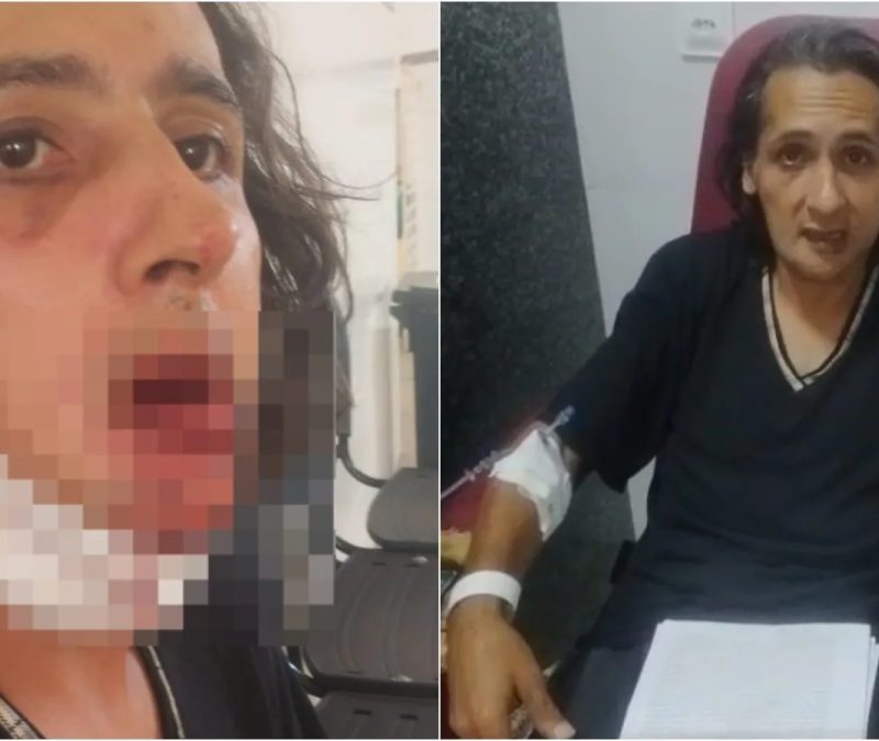 Agricultor é agredido e tem rosto fraturado após reclamar que companheiro foi impedido de usar passe-livre em van no Ceará
