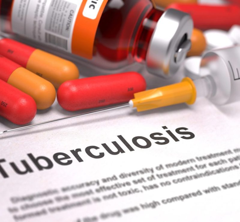 Casos de tuberculose aumentam em Imperatriz