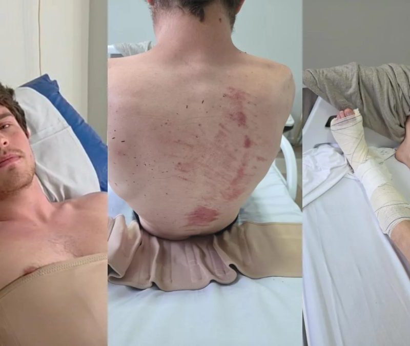 ‘É um alívio não estar no hospital, mas me sinto angustiado’, diz jovem atingido por galho na Praça Osório em Curitiba