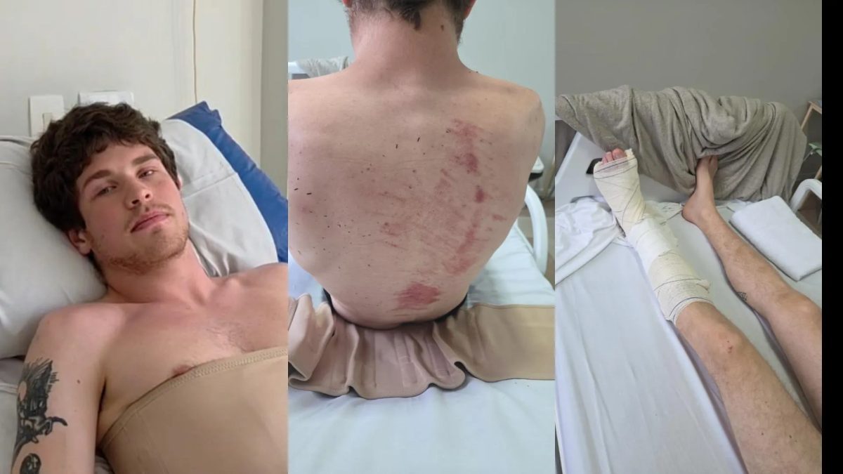 'É um alívio não estar no hospital, mas me sinto angustiado', diz jovem atingido por galho na Praça Osório em Curitiba