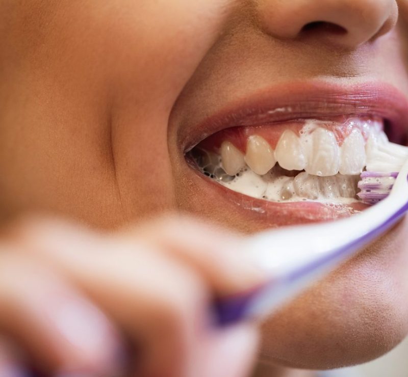 Escovar os dentes com força pode causar traumas na gengiva e no esmalte