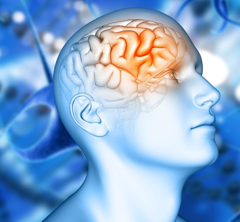 Estudo encontra variante genética que pode triplicar risco de Alzheimer