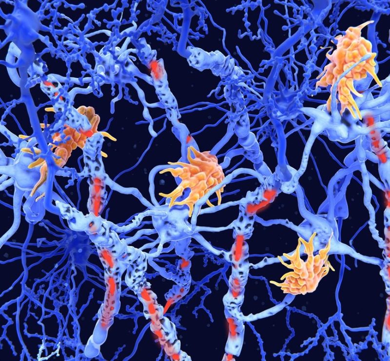 Estudo mostra avanço em terapias inovadoras para doenças neuroimunológicas