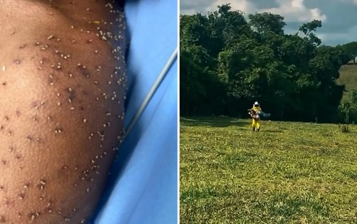 Homem leva centenas de picadas de abelhas em fazenda de Goiás
