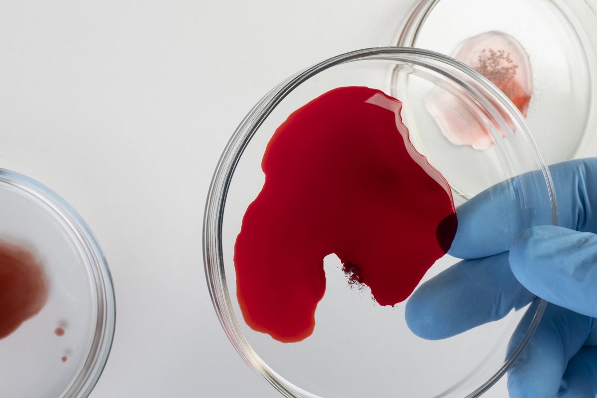 Jejum antes do exame de sangue pode não fazer diferença, sugere estudo
