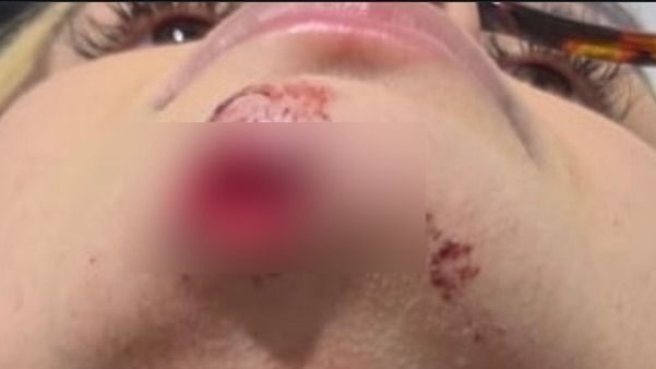 Justiça nega prisão de suspeito de agredir e arrastar influenciadora com carro em Maceió