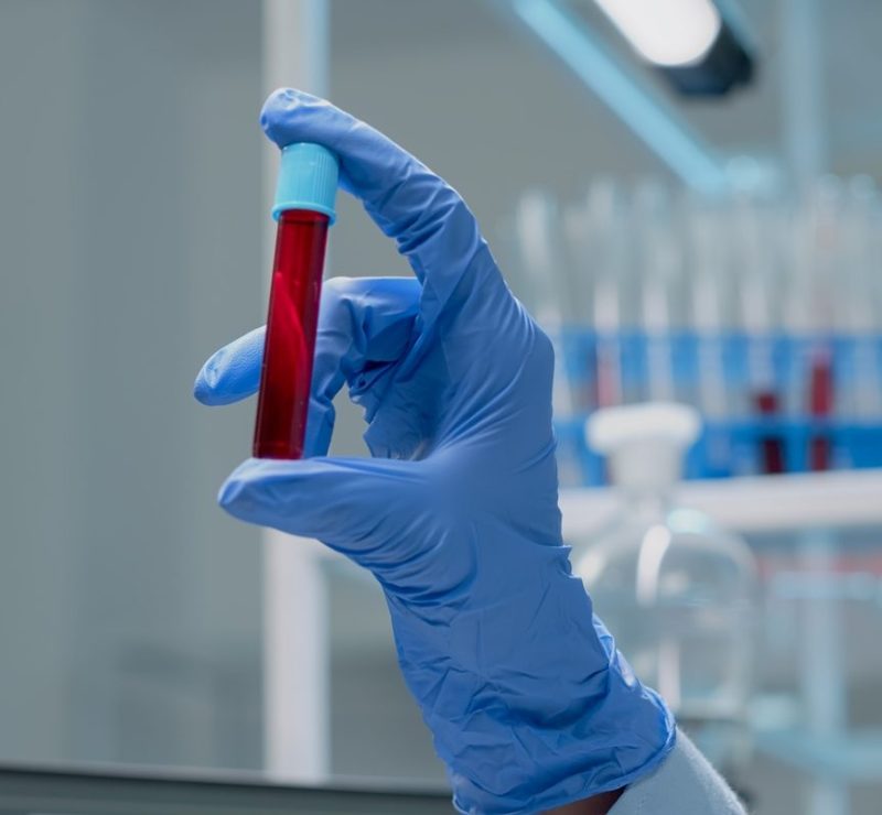 Novo exame de sangue que detecta mais de 50 tipos de câncer chega ao Brasil